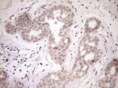 Immunohistochemistry-Paraffin: PARG Antibody (OTI6F4) [NBP2-46320]