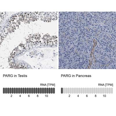 Immunohistochemistry-Paraffin: PARG Antibody [NBP1-89450]