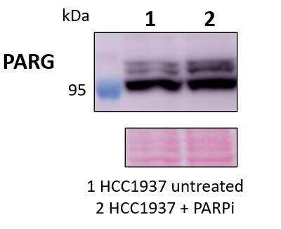 Western Blot: PARG AntibodyAzide and BSA Free [NBP2-94199]