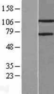 Western Blot: PARG Overexpression Lysate [NBL1-14104]