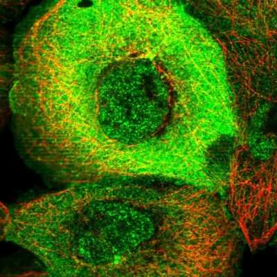 Immunocytochemistry/ Immunofluorescence: PARG1 Antibody [NBP1-87336]