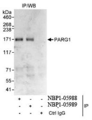 Immunoprecipitation: PARG1 Antibody [NBP1-05988]