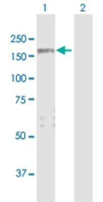 Western Blot: PARG1 Antibody [H00009411-B01P]