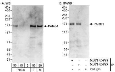 Western Blot: PARG1 Antibody [NBP1-05989]