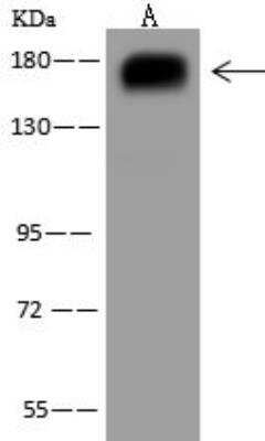 Western Blot: PARG1 Antibody [NBP3-12573]