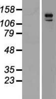 Western Blot: PARG1 Overexpression Lysate [NBL1-07670]