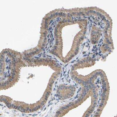 Immunohistochemistry-Paraffin: PARL Antibody [NBP1-80878]