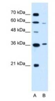 Western Blot: PARL Antibody [NBP1-59496]