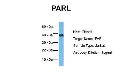 Western Blot: PARL Antibody [NBP1-59496]