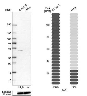 Western Blot: PARL Antibody [NBP1-80878]