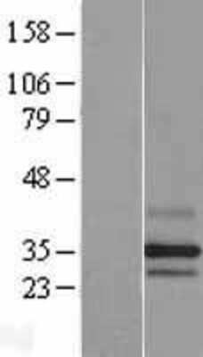 Western Blot: PARL Overexpression Lysate [NBL1-14107]