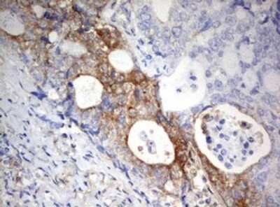 Immunohistochemistry: PARN Antibody (OTI4D12) [NBP2-46321]
