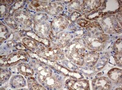 Immunohistochemistry: PARN Antibody (OTI4D12) [NBP2-46321]