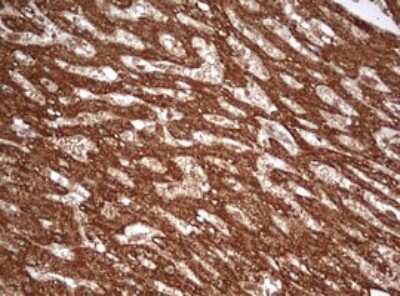 Immunohistochemistry: PARN Antibody (OTI4D12) [NBP2-46321]