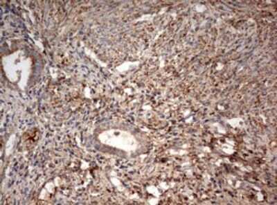Immunohistochemistry: PARN Antibody (OTI4D12) [NBP2-46321]