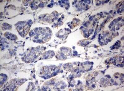 Immunohistochemistry: PARN Antibody (OTI4D12) [NBP2-46321]