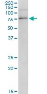 Western Blot: PARN Antibody [H00005073-B01P]