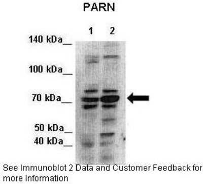 Western Blot: PARN Antibody [NBP1-80250]