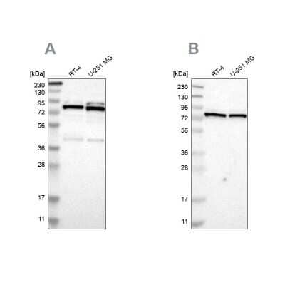Western Blot: PARN Antibody [NBP1-84302]