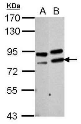 Western Blot: PARN Antibody [NBP2-19696]