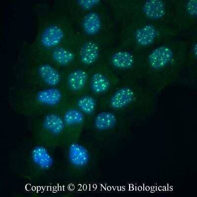 Immunocytochemistry/ Immunofluorescence: PARP Antibody (194C1439) - Cleaved - Azide and BSA Free [NBP2-27335]
