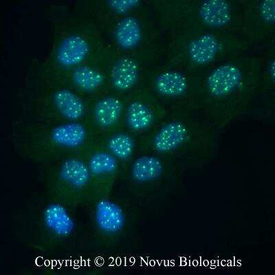 Immunocytochemistry/ Immunofluorescence: PARP Antibody (194C1439) - Cleaved - BSA Free [NB100-56599]