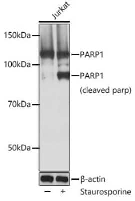 Western Blot: PARP Antibody (2G8N7) [NBP3-15802]