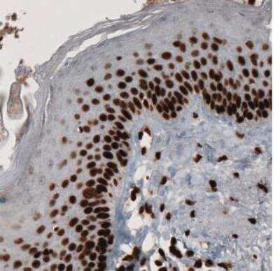 Immunohistochemistry-Paraffin: PARP Antibody (CL2209) [NBP2-36748]