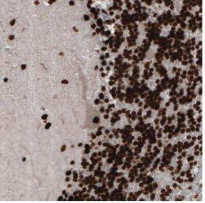 Immunohistochemistry-Paraffin: PARP Antibody (CL2209) [NBP2-36748]