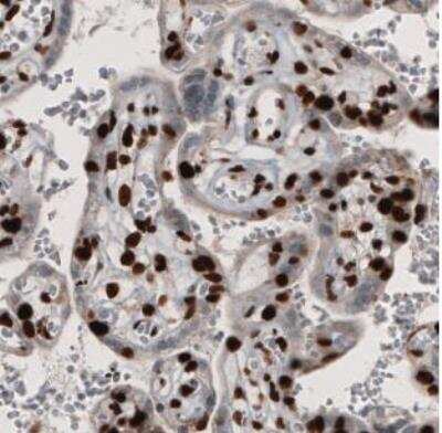 Immunohistochemistry-Paraffin: PARP Antibody (CL2209) [NBP2-36748]
