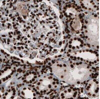 Immunohistochemistry-Paraffin: PARP Antibody (CL2209) [NBP2-36748]
