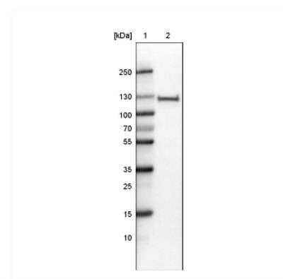 Western Blot: PARP Antibody (CL2209) [NBP2-36748]