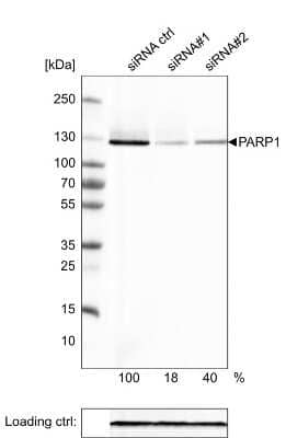 Western Blot: PARP Antibody (CL2209) [NBP2-36748]