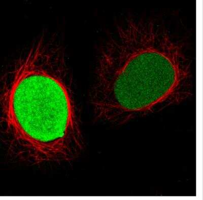 Immunocytochemistry/ Immunofluorescence: PARP Antibody (CL2220) [NBP2-36747]
