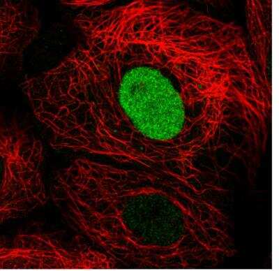 Immunocytochemistry/ Immunofluorescence: PARP Antibody (CL2220) [NBP2-36747]