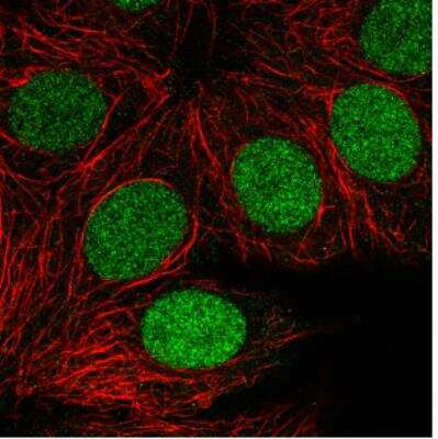 Immunocytochemistry/ Immunofluorescence: PARP Antibody (CL2220) [NBP2-36747]