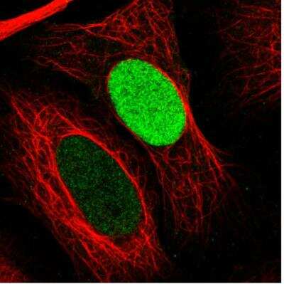 Immunocytochemistry/ Immunofluorescence: PARP Antibody (CL2220) [NBP2-36747]