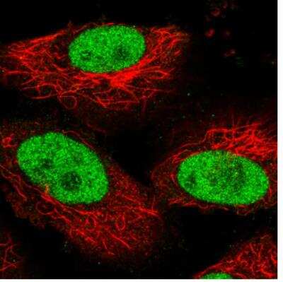 Immunocytochemistry/ Immunofluorescence: PARP Antibody (CL2220) [NBP2-36747]