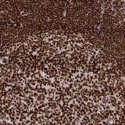 Immunohistochemistry-Paraffin: PARP Antibody (CL2220) [NBP2-36747]