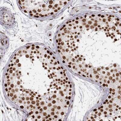 Immunohistochemistry-Paraffin: PARP Antibody (CL2220) [NBP2-36747]