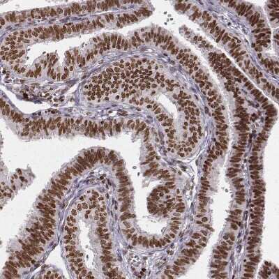 Immunohistochemistry-Paraffin: PARP Antibody (CL2220) [NBP2-36747]