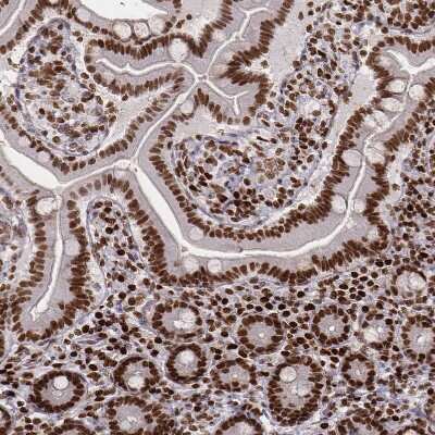 Immunohistochemistry-Paraffin: PARP Antibody (CL2220) [NBP2-36747]