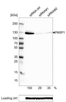 Western Blot: PARP Antibody (CL2220) [NBP2-36747]