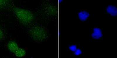 Immunocytochemistry/ Immunofluorescence: PARP Antibody [NBP3-09070]