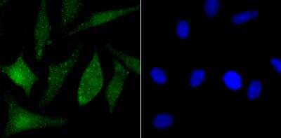 Immunocytochemistry/ Immunofluorescence: PARP Antibody [NBP3-09070]