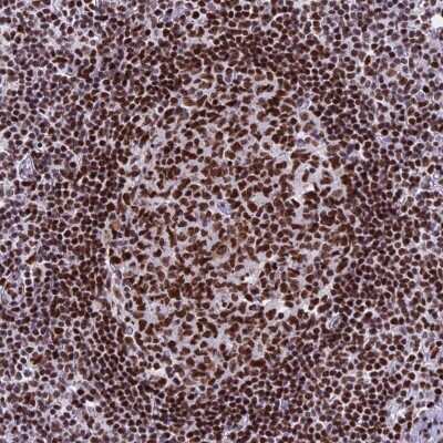 Immunohistochemistry-Paraffin: PARP Antibody [NBP2-13732]