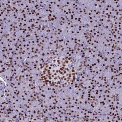 Immunohistochemistry-Paraffin: PARP Antibody [NBP2-13732]