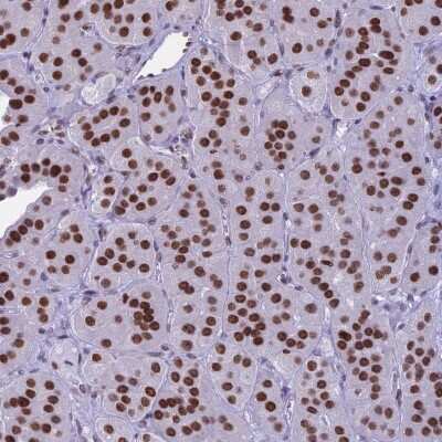 Immunohistochemistry-Paraffin: PARP Antibody [NBP2-13732]