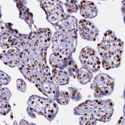 Immunohistochemistry-Paraffin: PARP Antibody [NBP2-13732]