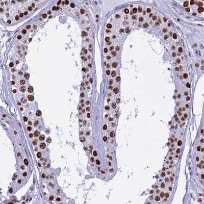 Immunohistochemistry-Paraffin: PARP Antibody [NBP2-13732]